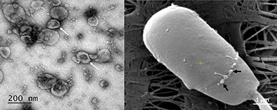 High-magnification images of porcine oviductal extracellular vesicles adhering to spermatozoa.
