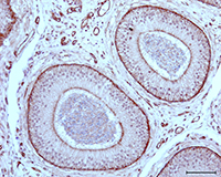 Illustrative photograph of aquaglyceroporin immunolabeling (AQP9 expression in corpus region of Iberian ibex epididymis)