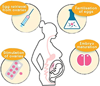 Diagram depicting four key elements of assisted reproduction treatment.