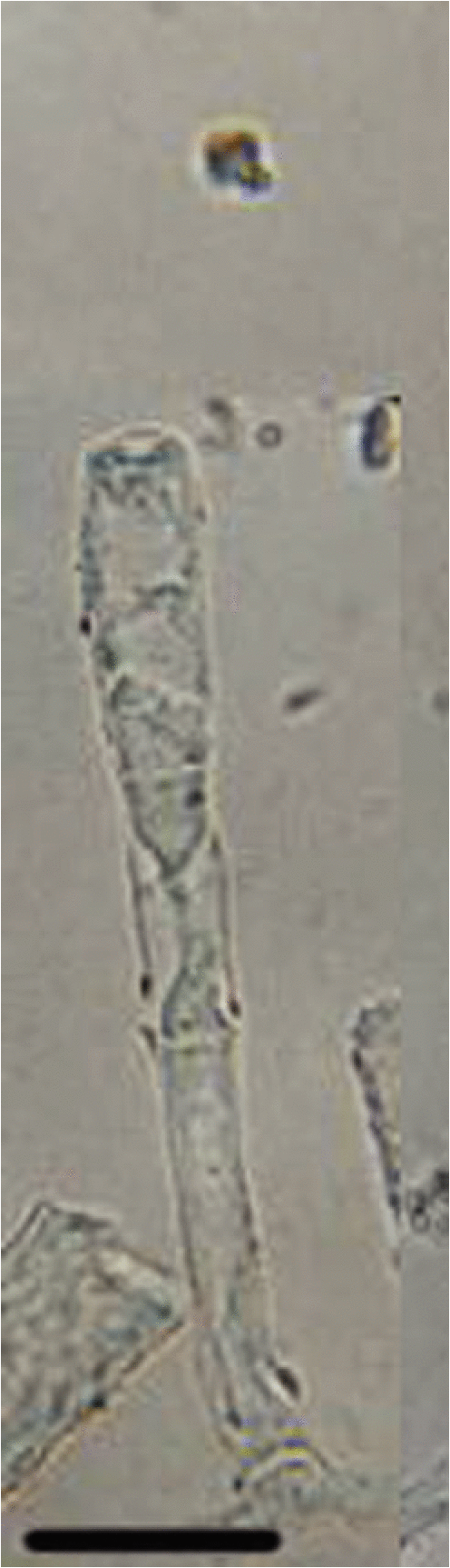 F5