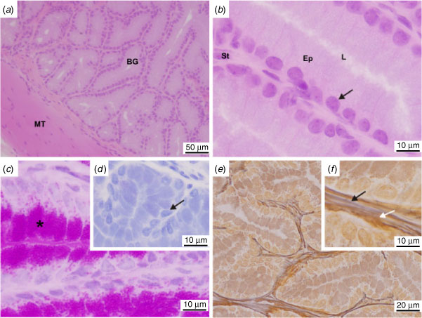 prostata histologia normal