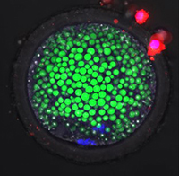 Representative confocal microscopy image of stage MII oocyte showing active mitochondria, lipid droplets & nuclear DNA.