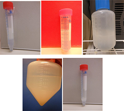 Single Layer Centrifugation for different volumes of semen