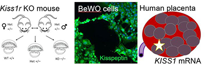 Illustration of the three experimental models used to elucidate kisspeptin’s role in trophoblast invasion and migration.