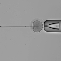 Photograph of a sperm being injected into an egg as part of the intracytoplasmic sperm injection or ICSI technique.