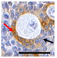Primary follicle in mouse ovarian section with both AMH-positive and AMH-negative granulosa cells.