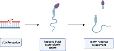 Mutation in SUN5 gene linked to acephalic spermatozoa syndrome and male infertility insights.