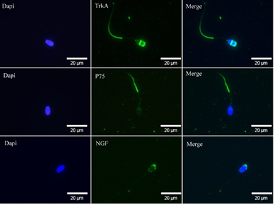 Fluorescent immunohistochemistry image showing the presence of nerve growth factor β, p75 and TrkA in ram spermatozoa.